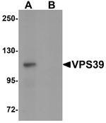 VPS39 Antibody in Western Blot (WB)