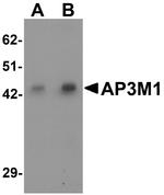 AP3M1 Antibody in Western Blot (WB)