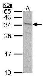 GEM Antibody in Western Blot (WB)