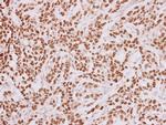 HMGA2 Antibody in Immunohistochemistry (Paraffin) (IHC (P))