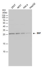 BNP Antibody in Western Blot (WB)