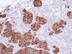 S100A11 Antibody in Immunohistochemistry (Paraffin) (IHC (P))