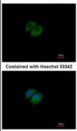 HPRT1 Antibody in Immunocytochemistry (ICC/IF)