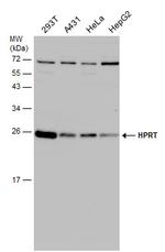 HPRT1 Antibody in Western Blot (WB)