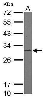 CAPZB Antibody in Western Blot (WB)
