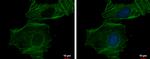 alpha-Cardiac Actin Antibody in Immunocytochemistry (ICC/IF)