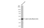 alpha-Cardiac Actin Antibody in Western Blot (WB)