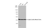 alpha-Cardiac Actin Antibody in Western Blot (WB)