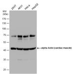 alpha-Cardiac Actin Antibody in Western Blot (WB)
