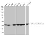 alpha-Cardiac Actin Antibody in Western Blot (WB)