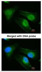 DNAJB6 Antibody in Immunocytochemistry (ICC/IF)