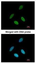 TAP Antibody in Immunocytochemistry (ICC/IF)