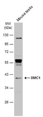 DMC1 Antibody in Western Blot (WB)