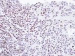 HMBOX1 Antibody in Immunohistochemistry (Paraffin) (IHC (P))