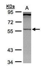 PCCB Antibody in Western Blot (WB)