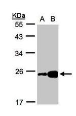 FABP6 Antibody in Western Blot (WB)