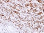 AKR1C1 Antibody in Immunohistochemistry (Paraffin) (IHC (P))