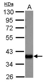 AKR1C1 Antibody in Western Blot (WB)