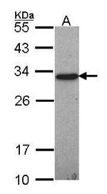 GST Omega 1 140A Antibody in Western Blot (WB)