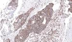 NDUFS4 Antibody in Immunohistochemistry (Paraffin) (IHC (P))