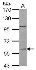 RGS14 Antibody in Western Blot (WB)