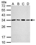 PSME3 Antibody in Western Blot (WB)
