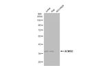 ACMSD Antibody in Western Blot (WB)