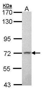 MPP2 Antibody in Western Blot (WB)