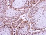 HS1BP3 Antibody in Immunohistochemistry (Paraffin) (IHC (P))