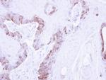 LIMK2 Antibody in Immunohistochemistry (Paraffin) (IHC (P))