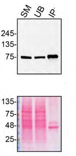 VPS35 Antibody in Immunoprecipitation (IP)