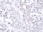 CAMK1D Antibody in Immunohistochemistry (Paraffin) (IHC (P))