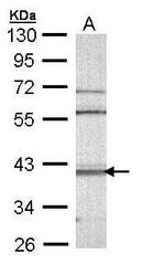 CAMK1D Antibody in Western Blot (WB)