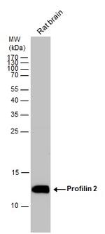 Profilin 2 Antibody in Western Blot (WB)