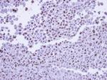 POLR2G Antibody in Immunohistochemistry (Paraffin) (IHC (P))