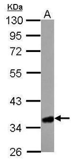 HMGCL Antibody in Western Blot (WB)