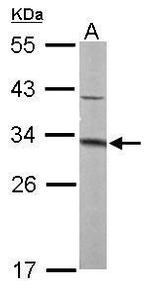 MTAP Antibody in Western Blot (WB)