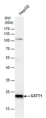 GSTT1 Antibody in Western Blot (WB)