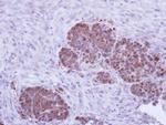 ZPR1 Antibody in Immunohistochemistry (Paraffin) (IHC (P))