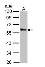 ZPR1 Antibody in Western Blot (WB)