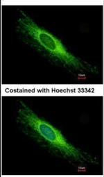 PEX26 Antibody in Immunocytochemistry (ICC/IF)