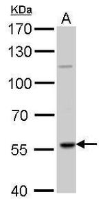 RAG2 Antibody in Western Blot (WB)