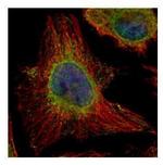 EPHX1 Antibody in Immunocytochemistry (ICC/IF)