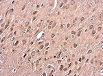 PKC alpha Antibody in Immunohistochemistry (Paraffin) (IHC (P))