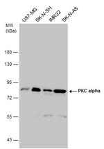 PKC alpha Antibody in Western Blot (WB)