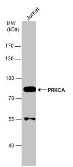 PKC alpha Antibody in Western Blot (WB)