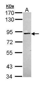 PKC alpha Antibody in Western Blot (WB)