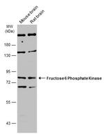 PFKM Antibody in Western Blot (WB)