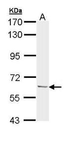 Ubiquilin 1 Antibody in Western Blot (WB)