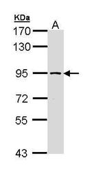 SSRP1 Antibody in Western Blot (WB)